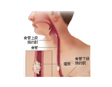 食管癌術后護理的新管理技術